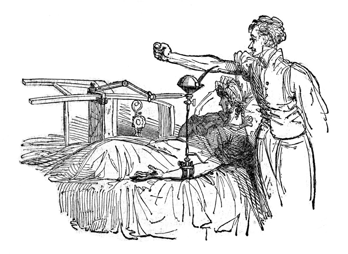 Nineteenth-century illustration of James Blundell's blood-transfusion method