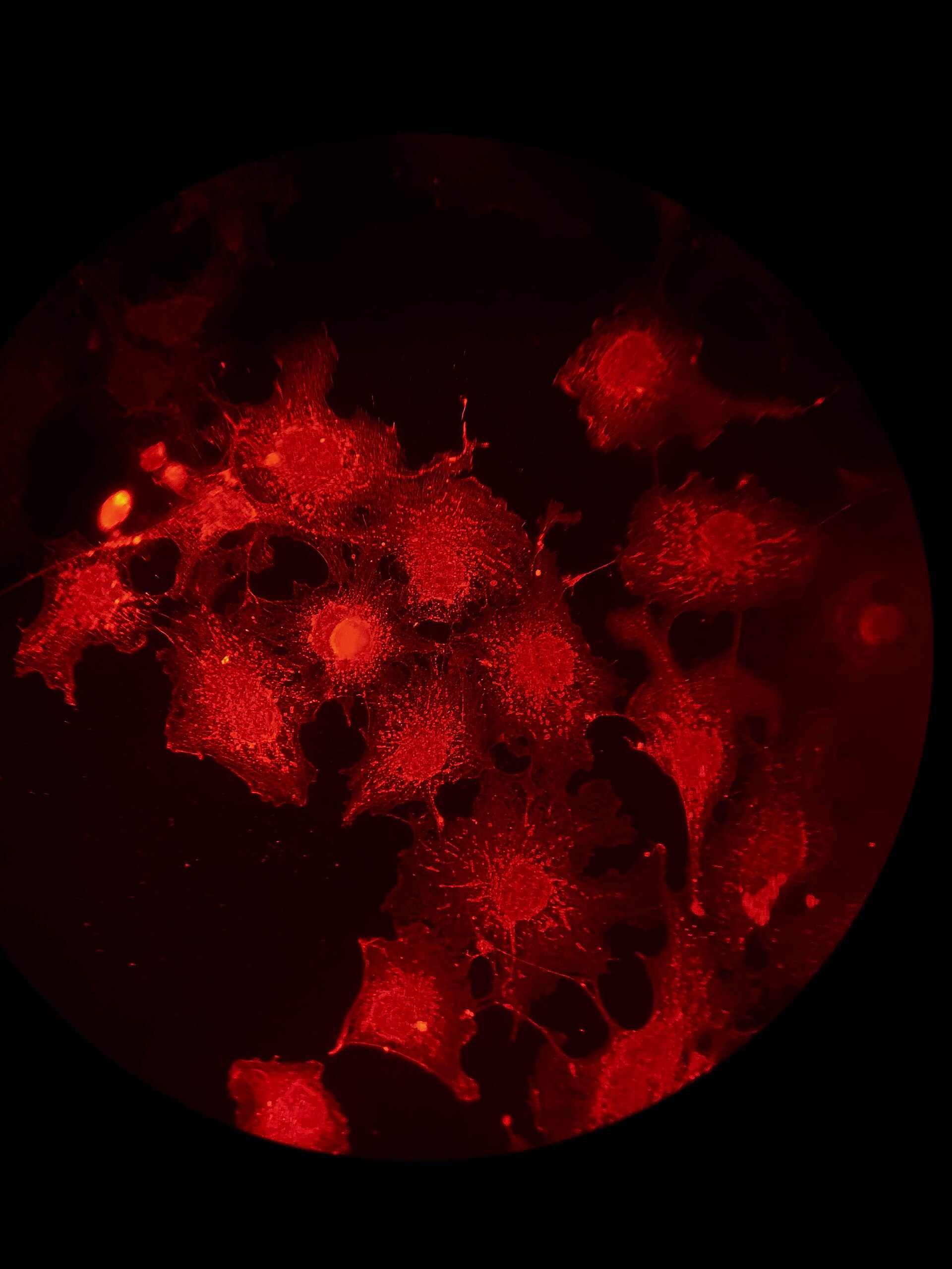 Cells viewed with fluorescence microscopy