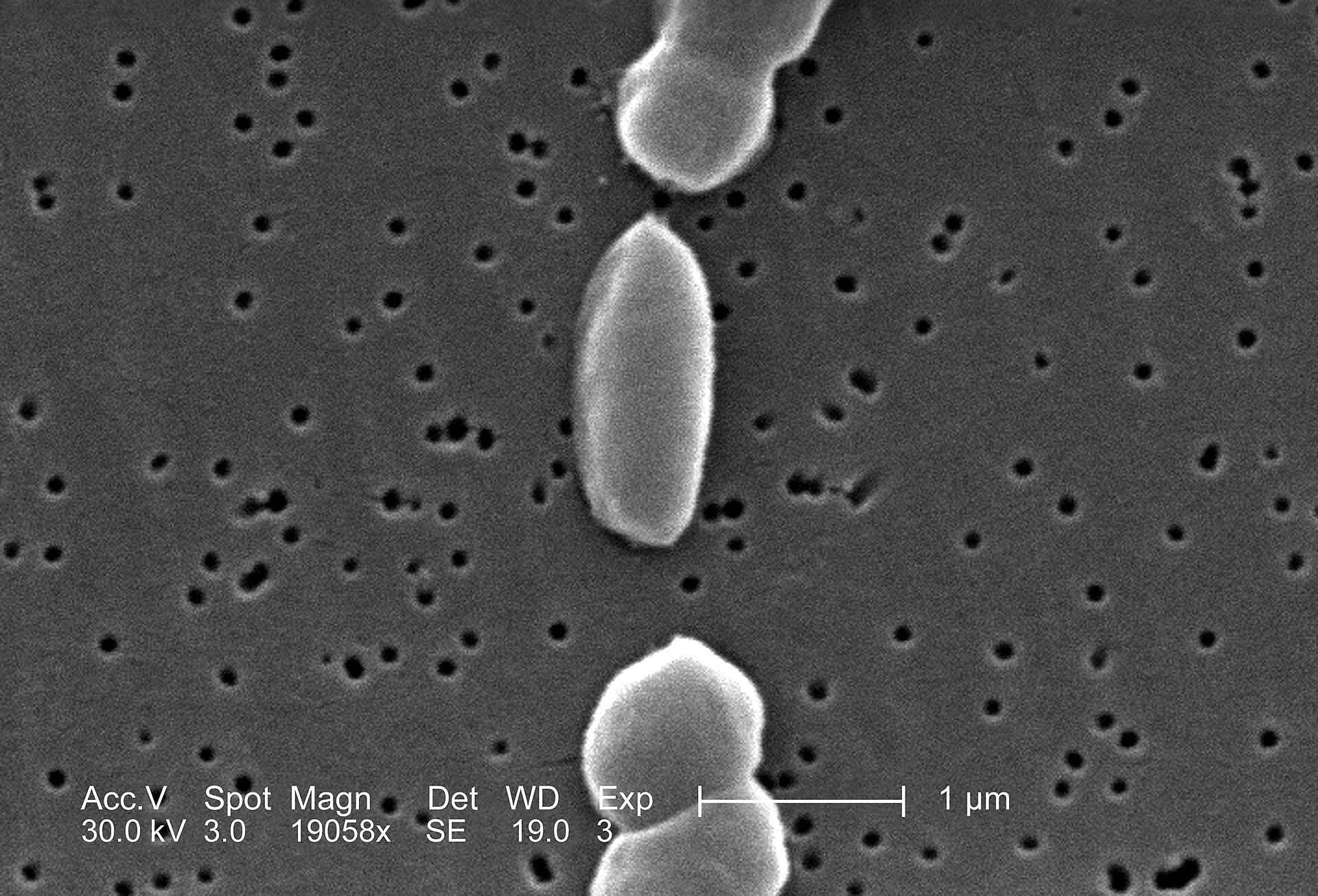Vibrio bacteria seen with a scanning electron microscope